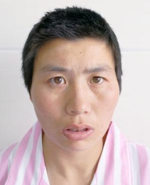 走失者照片 全国救助站