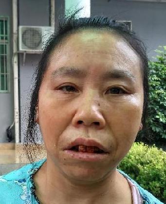 走失者照片 全国救助站
