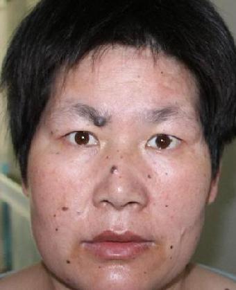 走失者照片 全国救助站