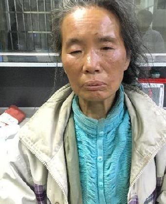 走失者照片 全国救助站