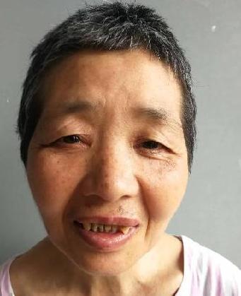 走失者照片 全国救助站