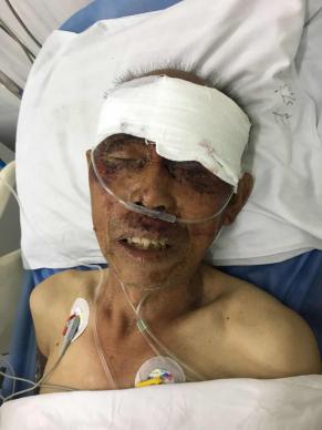 走失者照片 全国救助站