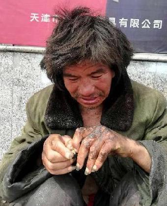 走失者照片 全国救助站