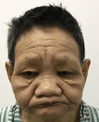走失者照片 全国救助站