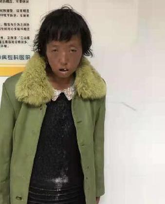 走失者照片 全国救助站