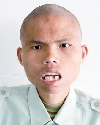 走失者照片 全国救助站