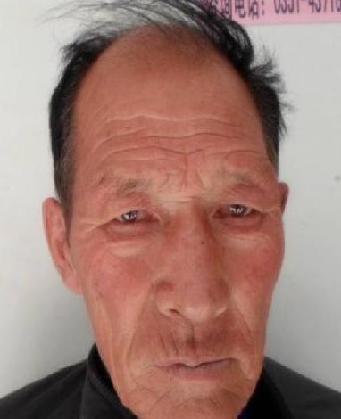 走失者照片 全国救助站