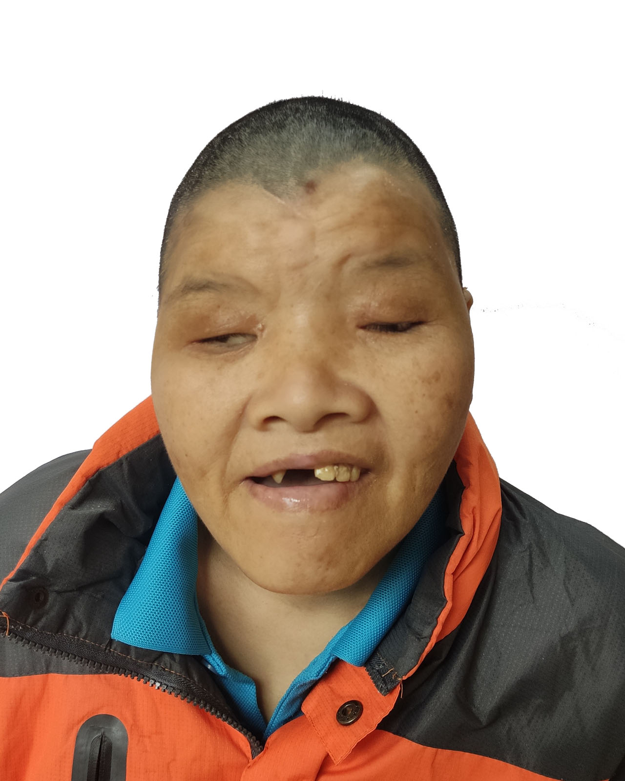 走失者照片 全国救助站