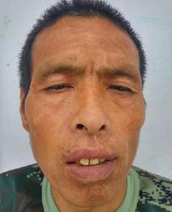 走失者照片 全国救助站