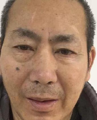 走失者照片 全国救助站