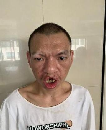 走失者照片 全国救助站