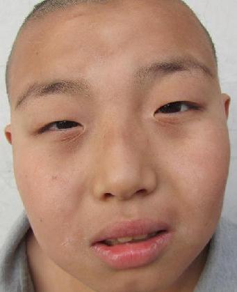 走失者照片 全国救助站