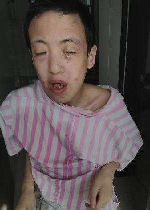 走失者照片 全国救助站