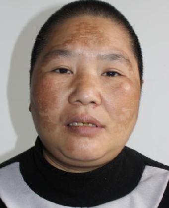 走失者照片 全国救助站