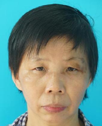 走失者照片 全国救助站