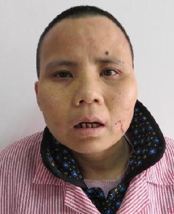 走失者照片 全国救助站