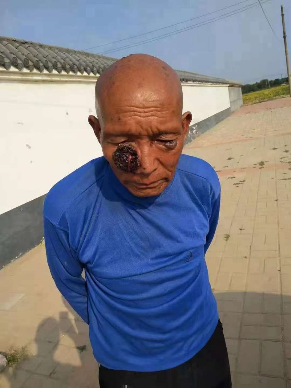 走失者照片 请各位好心人帮忙转发一下吧！好人一...