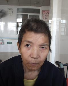 走失者照片 全国救助站
