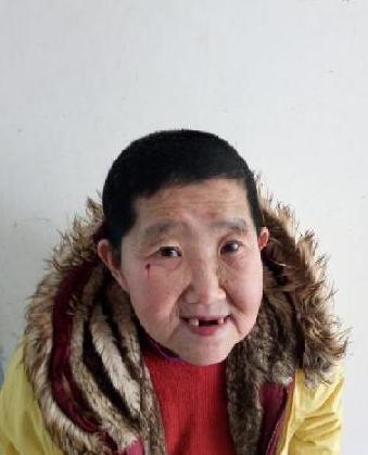 走失者照片 全国救助站