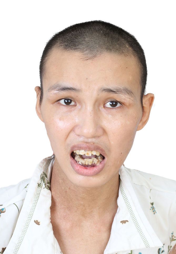 走失者照片 全国救助站