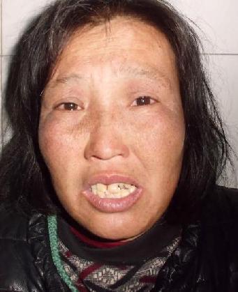 走失者照片 全国救助站