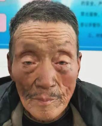 走失者照片 全国救助站