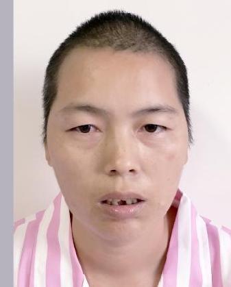 走失者照片 全国救助站