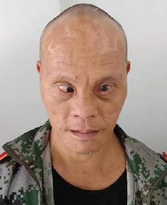 走失者照片 全国救助站