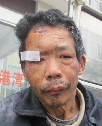 走失者照片 全国救助站
