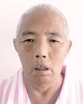 走失者照片 全国救助站