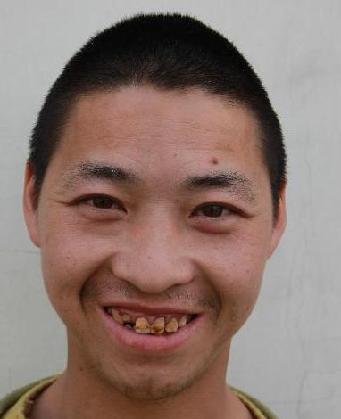 走失者照片 全国救助站