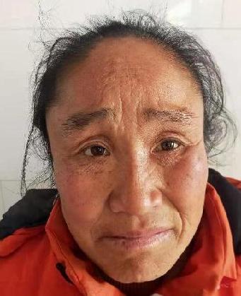 走失者照片 全国救助站