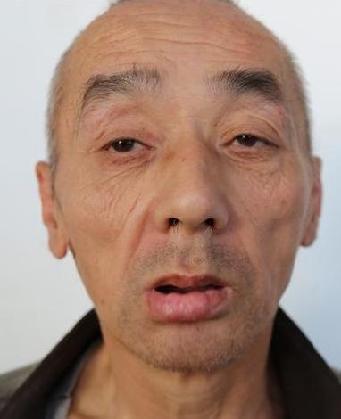 走失者照片 全国救助站