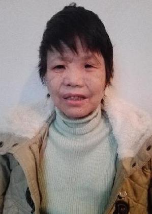 走失者照片 全国救助站