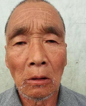 走失者照片 全国救助站