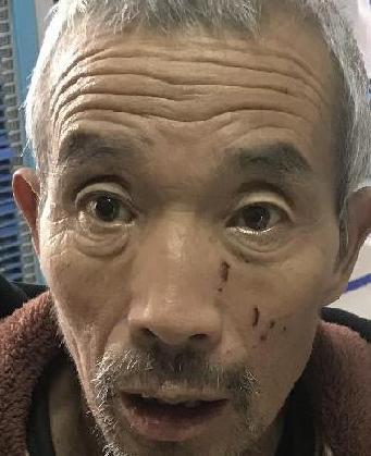 走失者照片 全国救助站