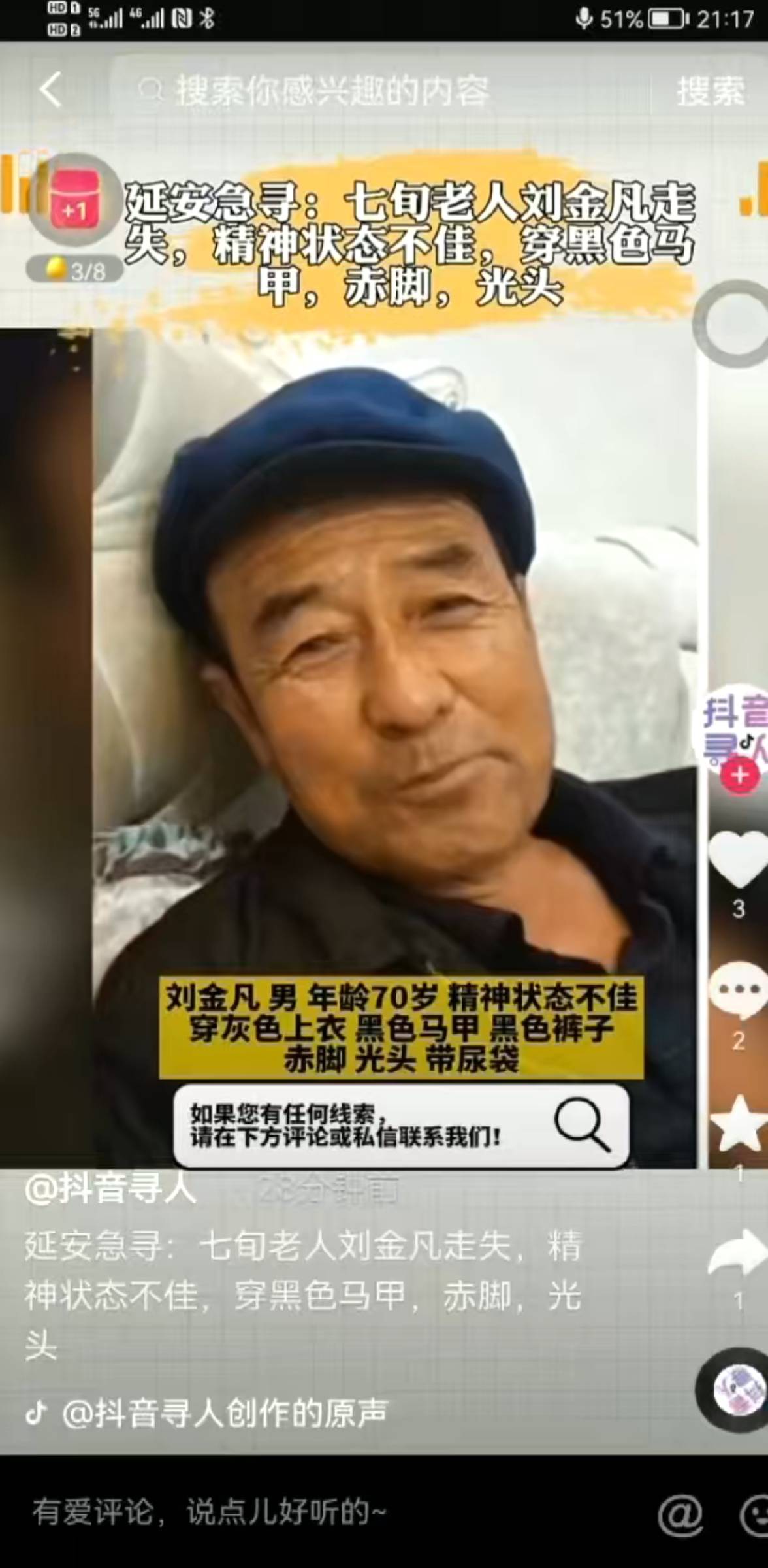 走失者照片 老人走失，望好心人提供线索。