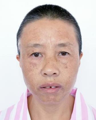 走失者照片 全国救助站