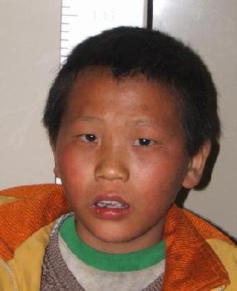 走失者照片 全国救助站