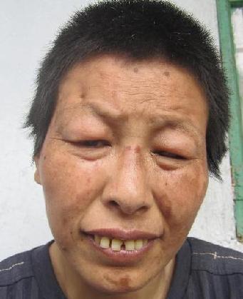 走失者照片 全国救助站