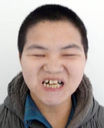 走失者照片 全国救助站