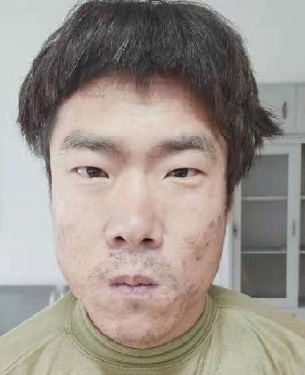 走失者照片 全国救助站