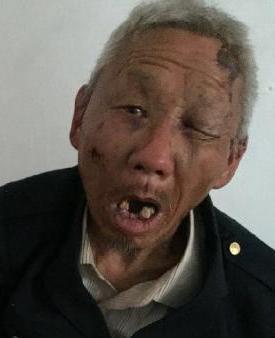 走失者照片 全国救助站