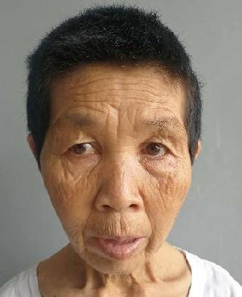 走失者照片 全国救助站
