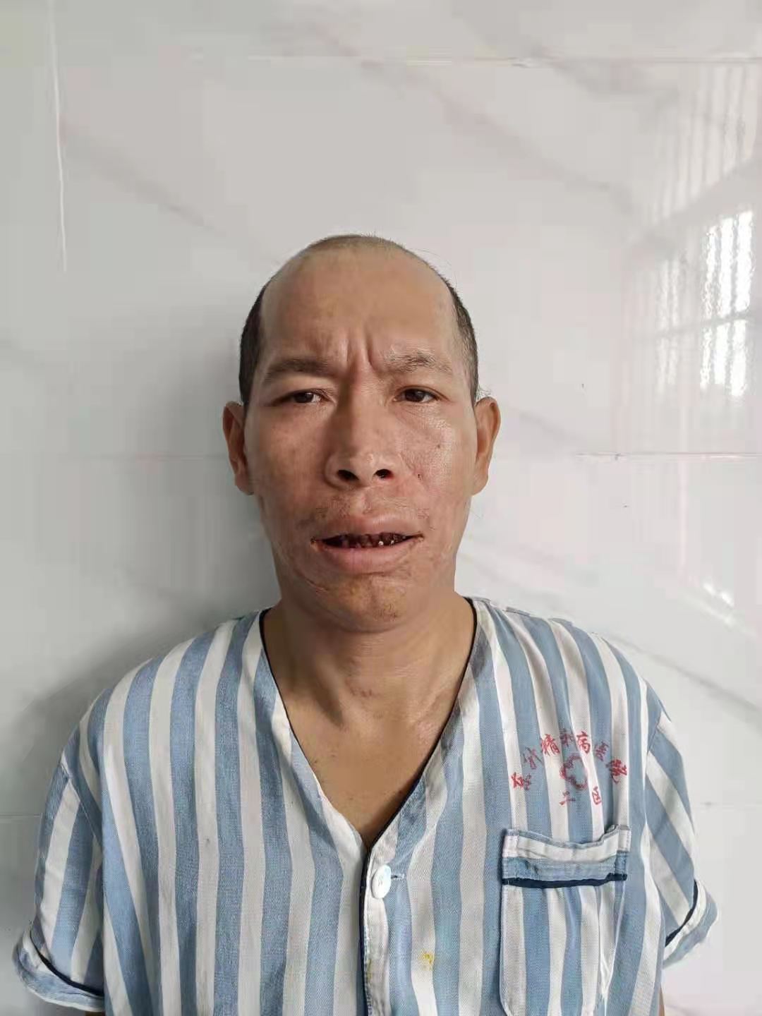 走失者照片 全国救助站