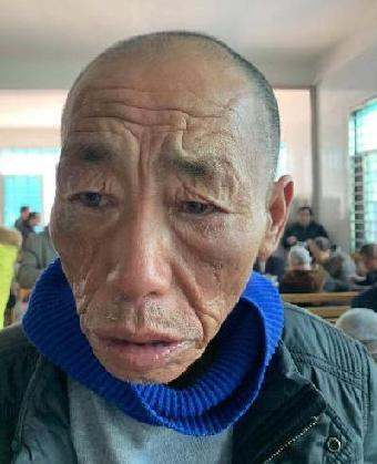 走失者照片 全国救助站