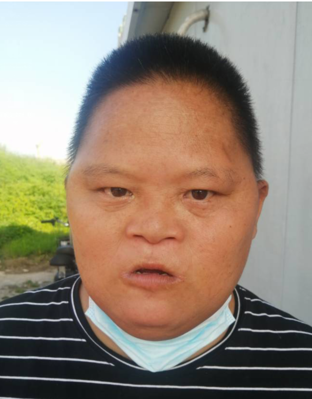 走失者照片 全国救助站