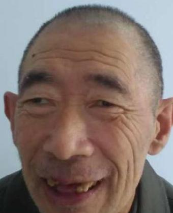 走失者照片 全国救助站