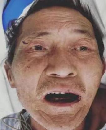 走失者照片 全国救助站