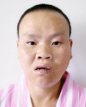 走失者照片 全国救助站